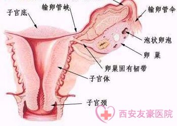 如何选择适合自己的治疗宫颈炎的方式？